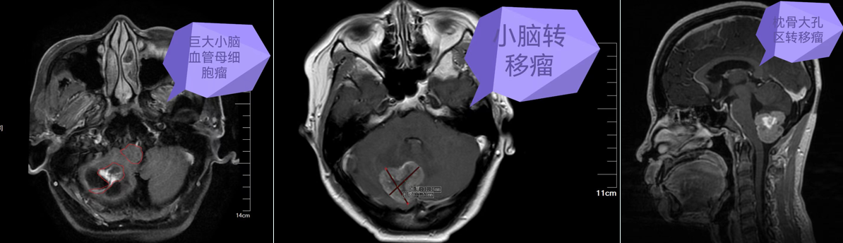 图片 6.png