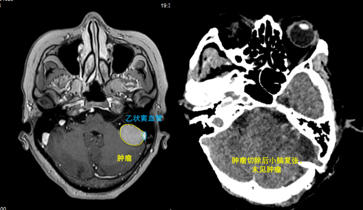 图片 7.png